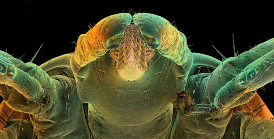 Scanning electron microscopy of the head of a tick