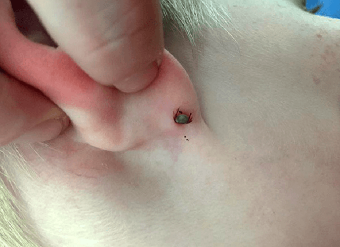 wood tick on the kid