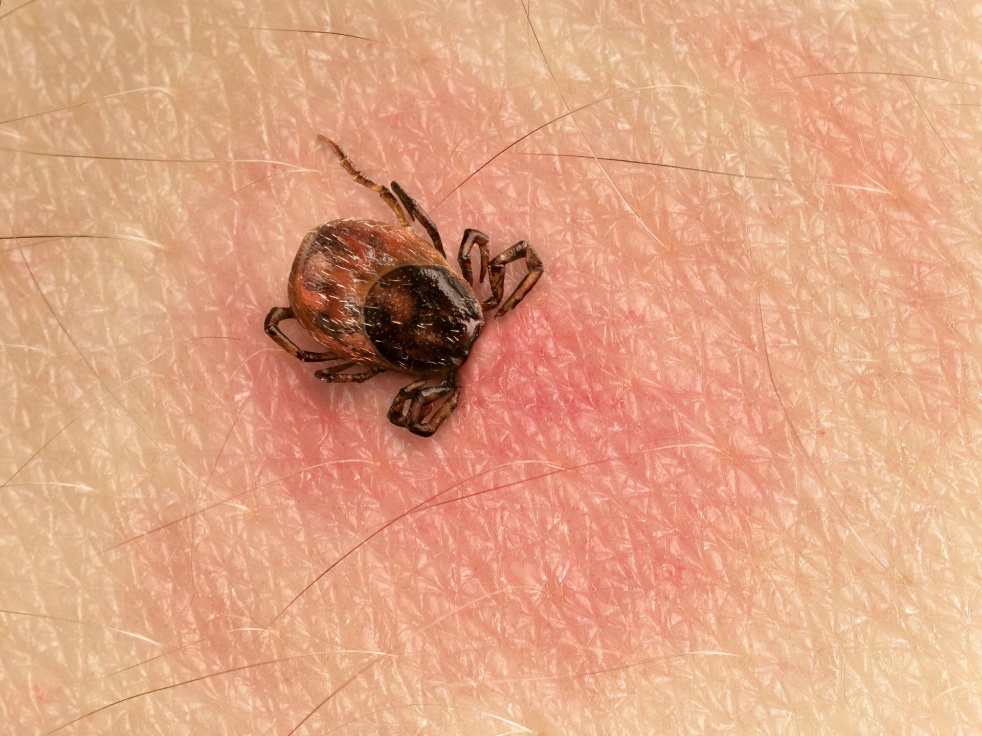 wooden tick bite