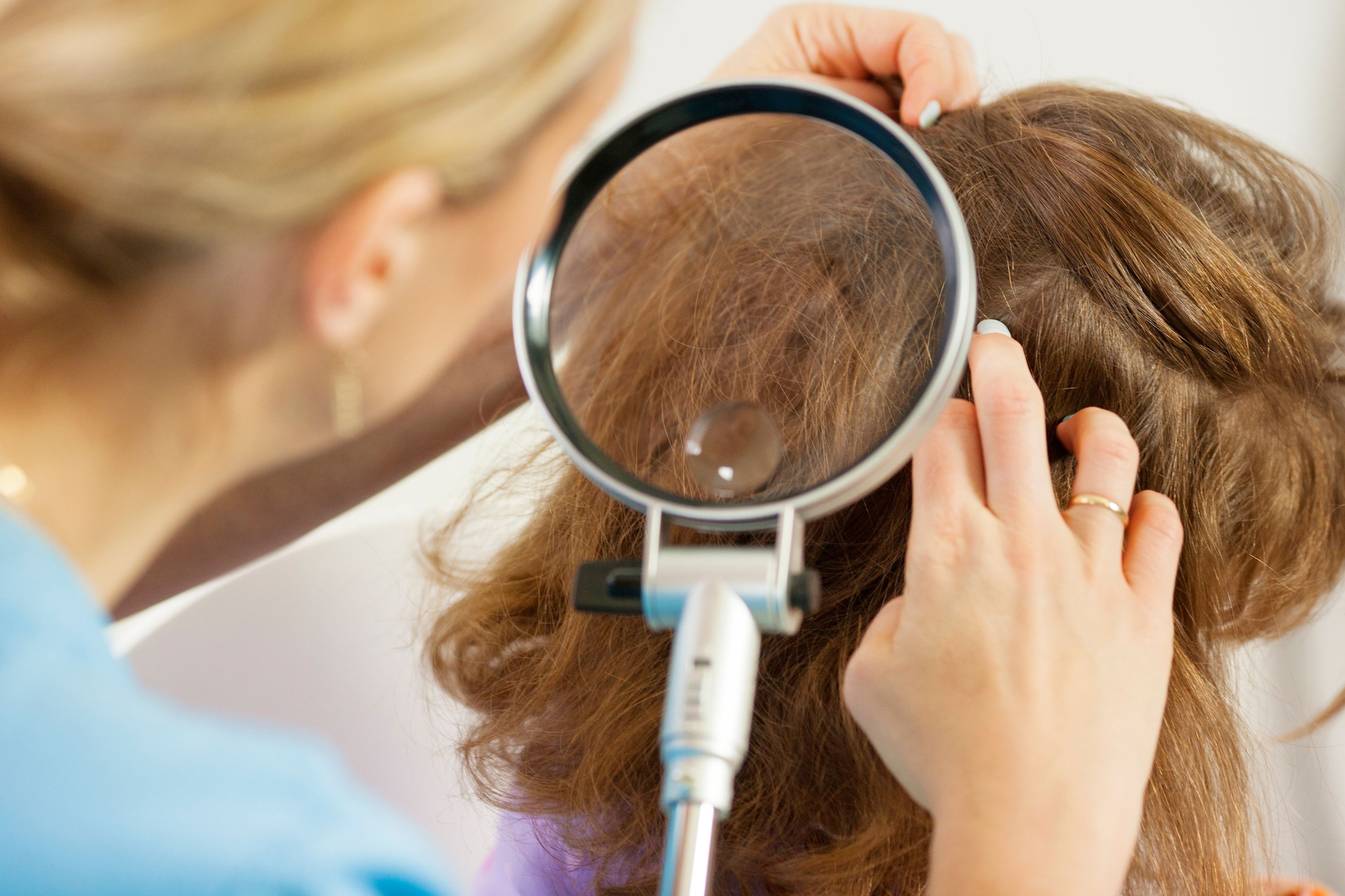 How Hair Dye May Kill Lice