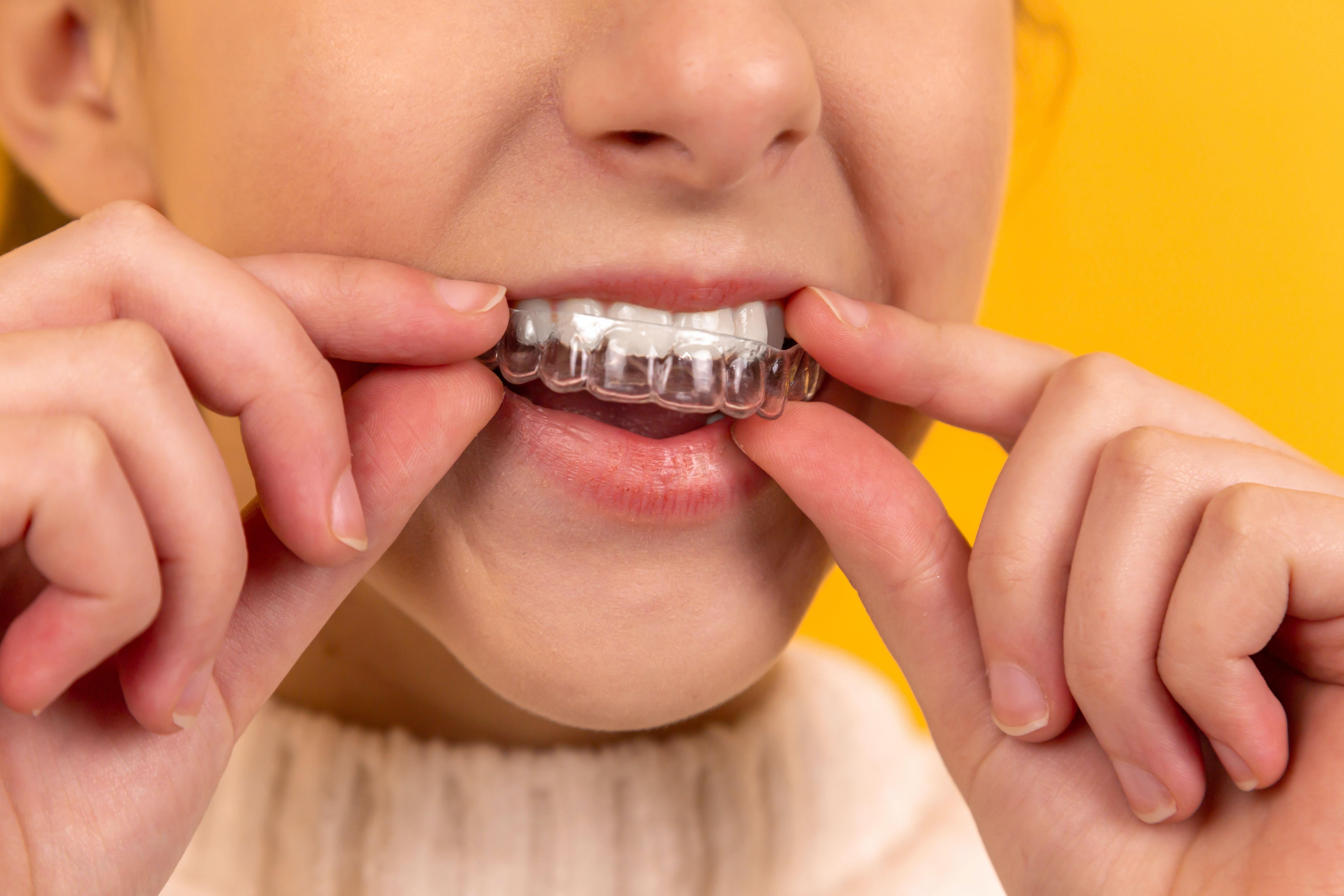 girl and teeth