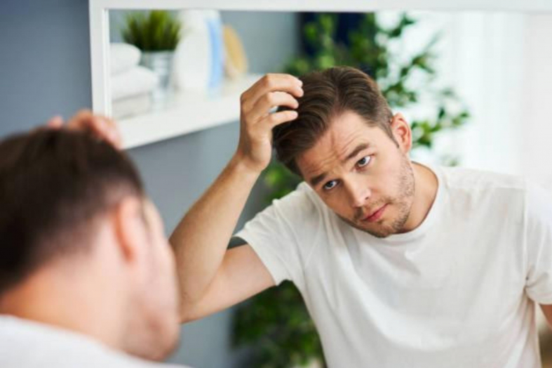 Going Bald A Brief Guide on Men’s Hair Loss