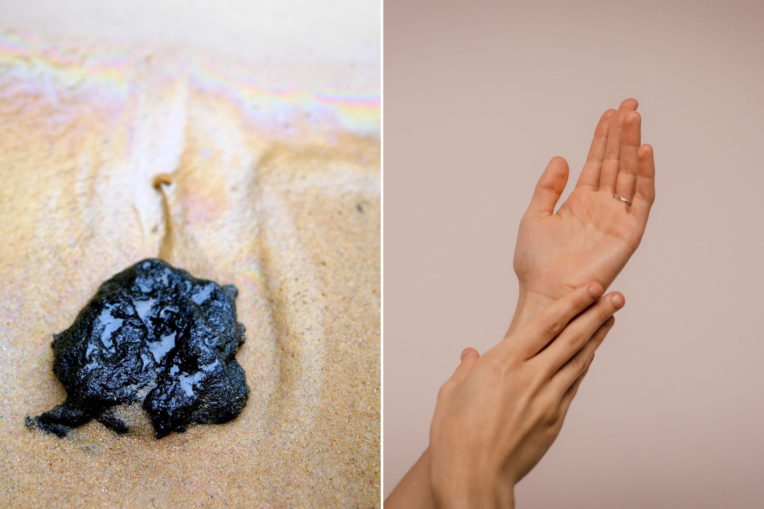 How to Get Black Tar Off Your Skin Using Household Products