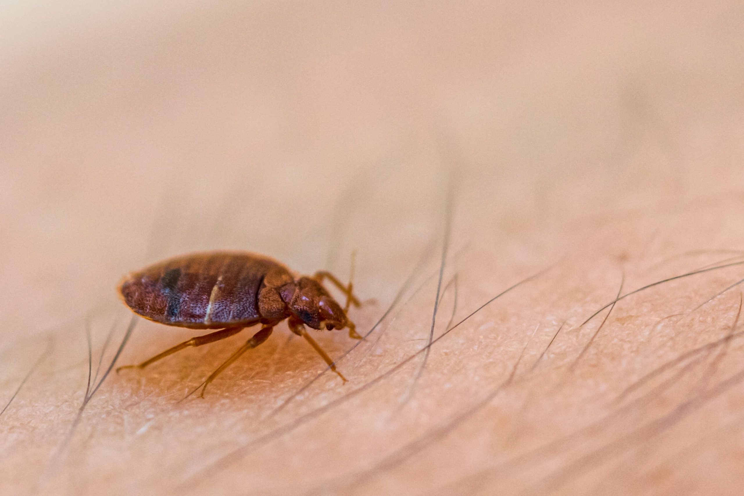 What Shall You Do to Prevent Bed Bugs From Biting You