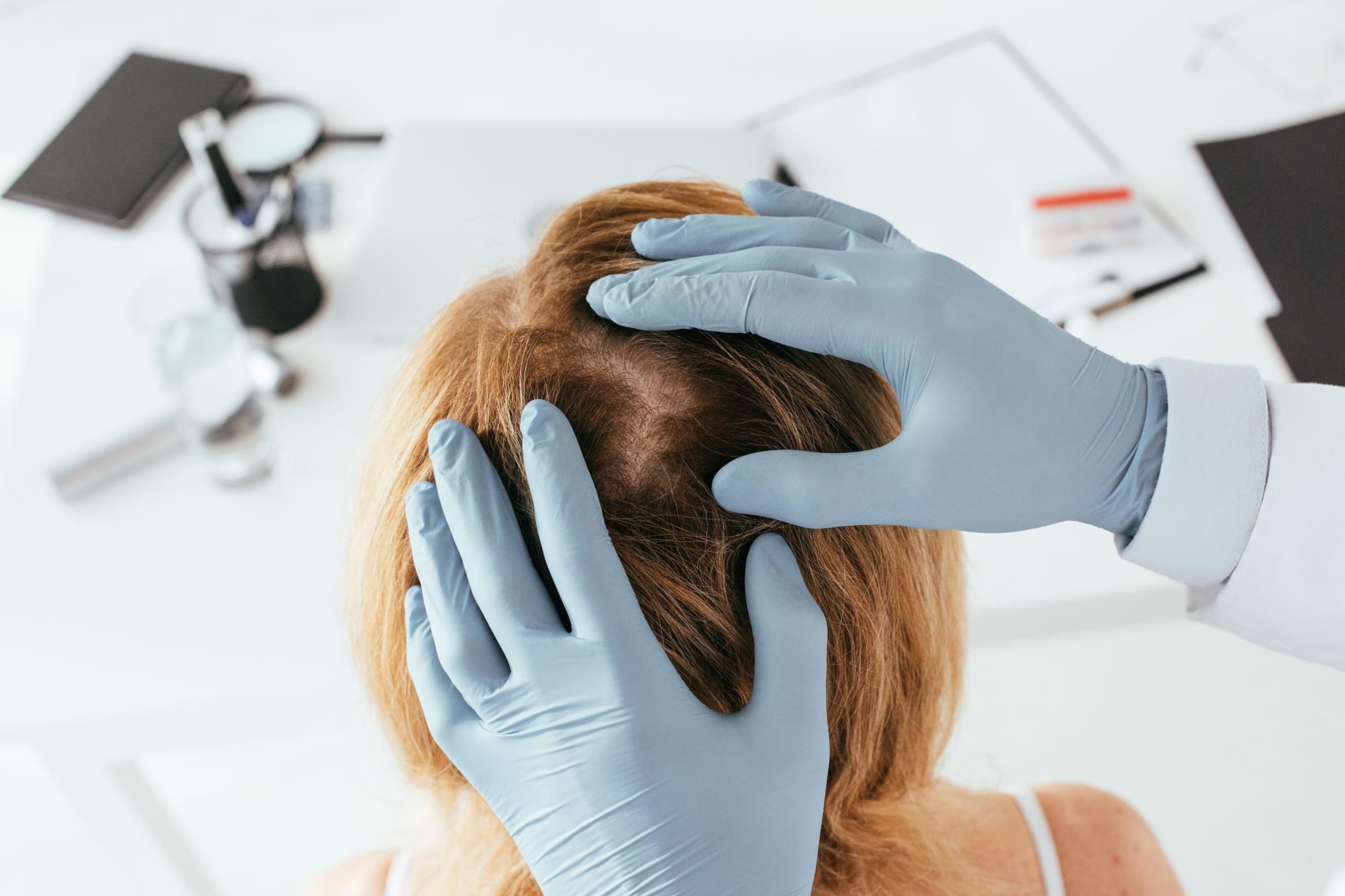 Ensure the Root Cause Is Not Dandruff