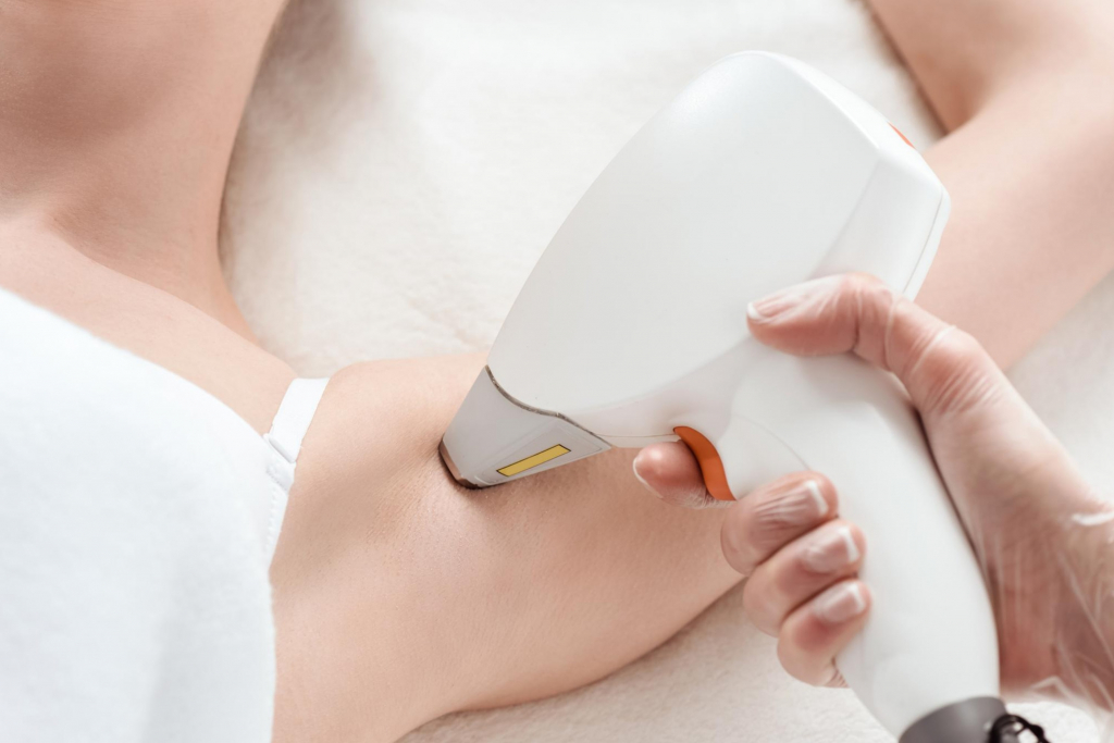 Laser Hair Removal Tipping Guide Everything You Need To Know