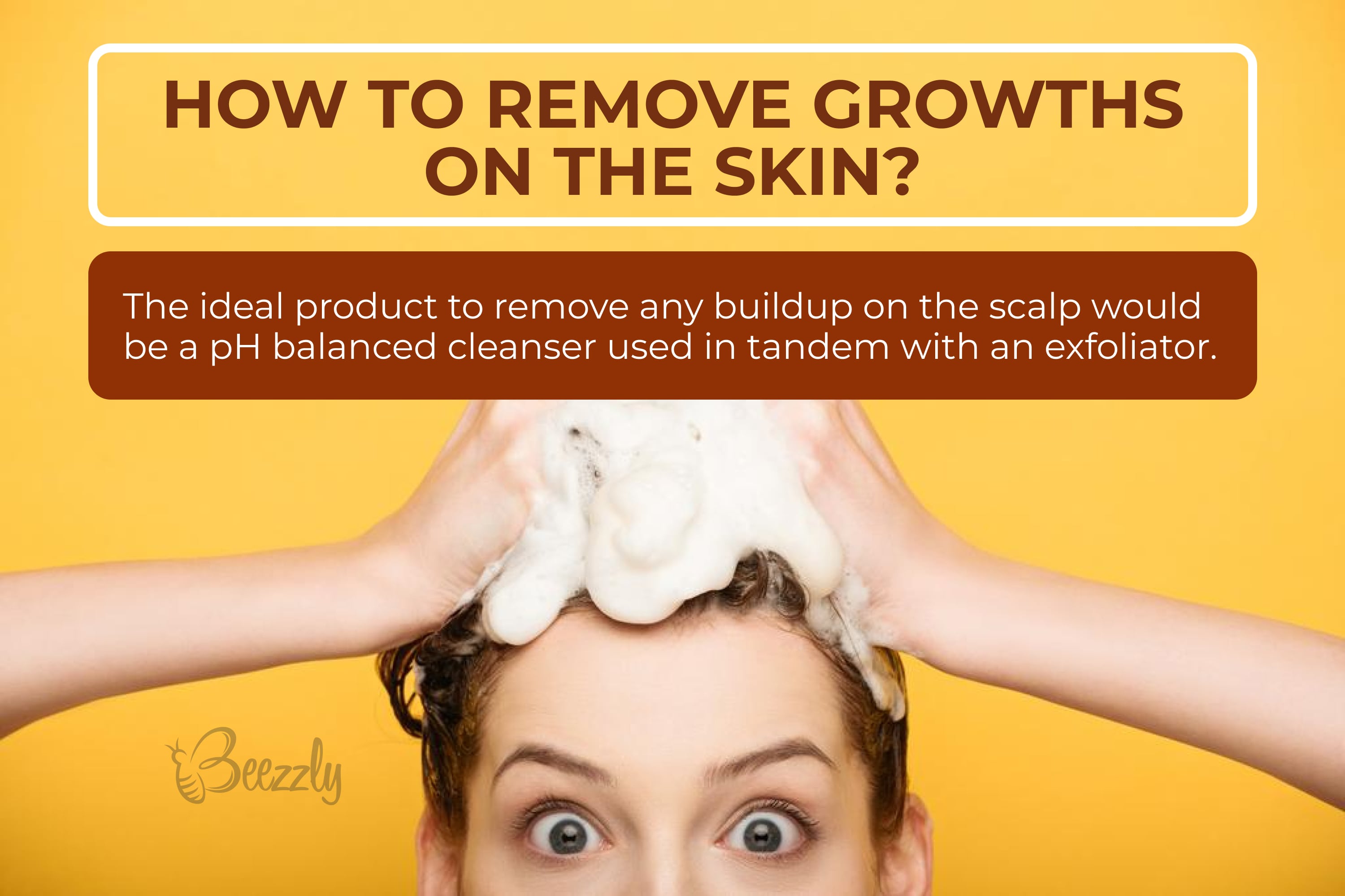 How to remove growths on the skin