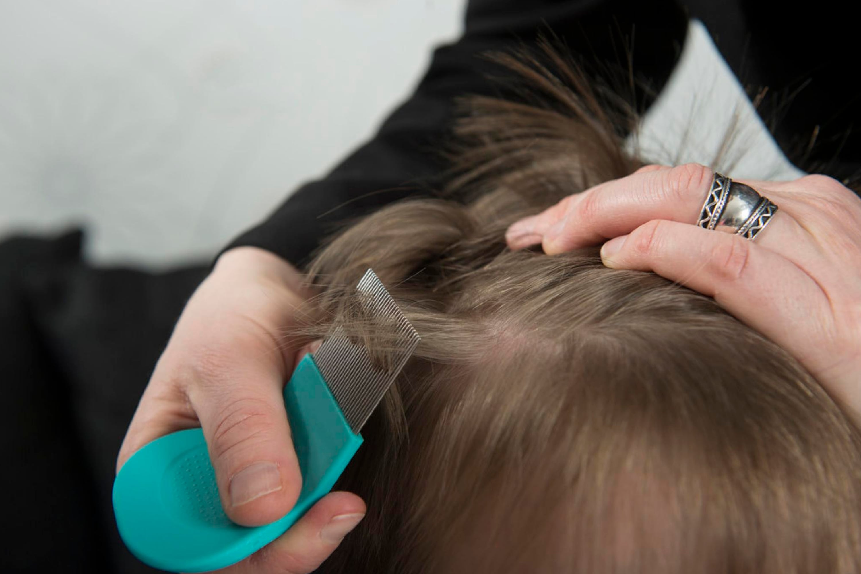 How to Prevent Lice