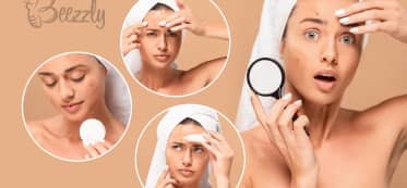 How to Get Rid of Pimples Overnight